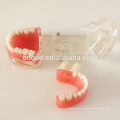 China Medical Anatomical Model Removable Soft Gingiva Standard Dental Jaw Model 13017